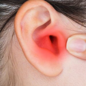 Dermatite alle orecchie